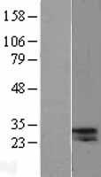 CELA2A Human Over-expression Lysate