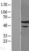 ZNF622 Human Over-expression Lysate