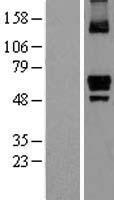 ITPRIP Human Over-expression Lysate