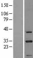CIP29 (SARNP) Human Over-expression Lysate