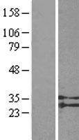 GPR91 (SUCNR1) Human Over-expression Lysate
