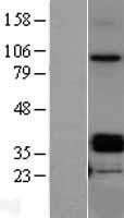 OIF (OGN) Human Over-expression Lysate