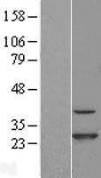 CINP Human Over-expression Lysate