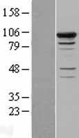 Smek1 (PPP4R3A) Human Over-expression Lysate