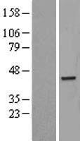 PARD6B Human Over-expression Lysate