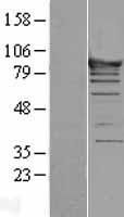 ASCC2 Human Over-expression Lysate