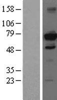 HDAC10 Human Over-expression Lysate