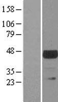 TSSK1 (TSSK1B) Human Over-expression Lysate