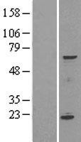 SPATA16 Human Over-expression Lysate