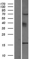 YPEL3 Human Over-expression Lysate