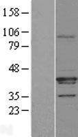 FAM108A1 (ABHD17A) Human Over-expression Lysate