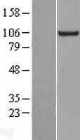 KIF18A Human Over-expression Lysate