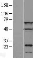 CDT1 Human Over-expression Lysate