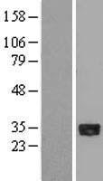 LANPL (ANP32E) Human Over-expression Lysate