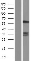 SNX27 Human Over-expression Lysate