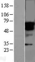 STK33 Human Over-expression Lysate