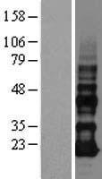 VOPP1 Human Over-expression Lysate