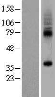 SLC35F5 Human Over-expression Lysate