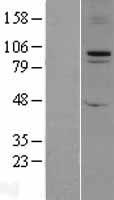 FBXO11 Human Over-expression Lysate