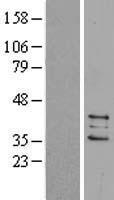 PTGES2 Human Over-expression Lysate