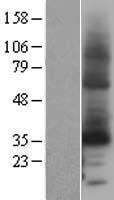 Cytochrome b reductase 1 (CYBRD1) Human Over-expression Lysate