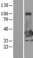 XLF (NHEJ1) Human Over-expression Lysate