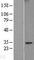 FAM124B Human Over-expression Lysate