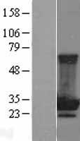 MOBKL2B (MOB3B) Human Over-expression Lysate