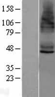 STEAP4 Human Over-expression Lysate