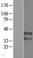 HOXD1 Human Over-expression Lysate