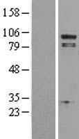 Phospholipase A2 (PLA2G4A) Human Over-expression Lysate