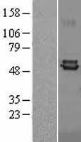 Ferredoxin Reductase (FDXR) Human Over-expression Lysate