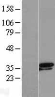 TSEN34 Human Over-expression Lysate