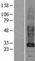 GJB3 Human Over-expression Lysate