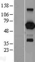 EBF1 Human Over-expression Lysate