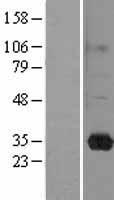 RASL11B Human Over-expression Lysate