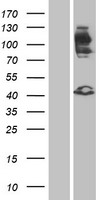 FGFR2 Human Over-expression Lysate