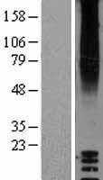 GPR87 Human Over-expression Lysate