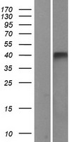 GPR86 (P2RY13) Human Over-expression Lysate