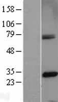 CENPH Human Over-expression Lysate