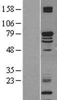 KLC2 Human Over-expression Lysate