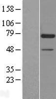 Artemis (DCLRE1C) Human Over-expression Lysate