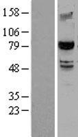 SMURF 2 (SMURF2) Human Over-expression Lysate