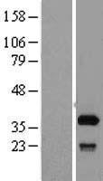 SFXN1 Human Over-expression Lysate