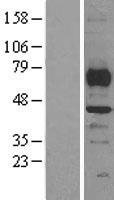 SMYD3 Human Over-expression Lysate