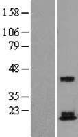 RPS18 Human Over-expression Lysate