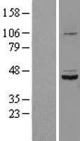 SDS3 (SUDS3) Human Over-expression Lysate