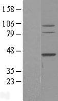 TFB2M Human Over-expression Lysate