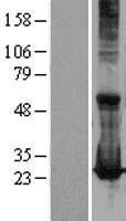 RAB17 Human Over-expression Lysate