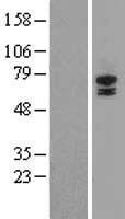 STRA6 Human Over-expression Lysate